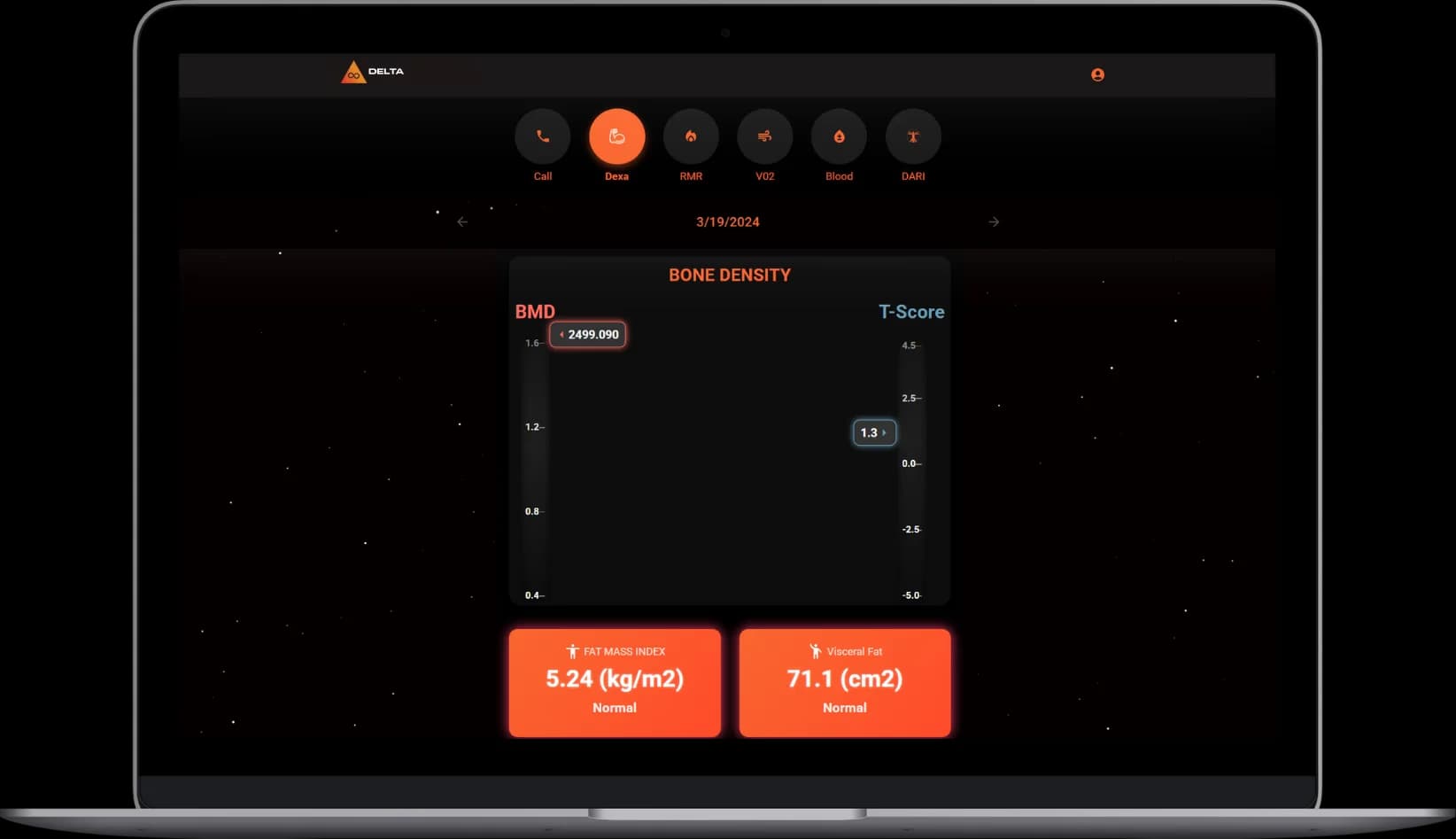 LATO AI Delta desktop dashboard showing bone density analysis with BMD, T-score, fat mass index, and visceral fat indicators for health performance monitoring.