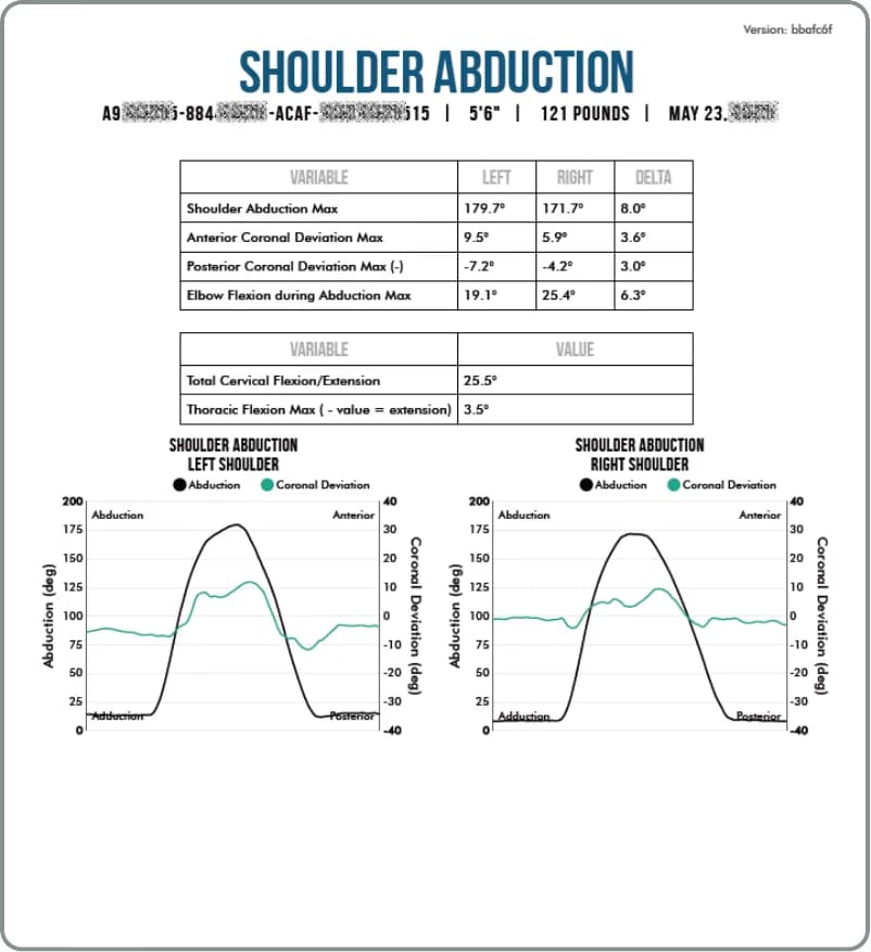 ChatGPT said: LATO AI Delta DARI motion analysis report showing shoulder abduction metrics, range of motion values, and performance graphs for left and right shoulders.