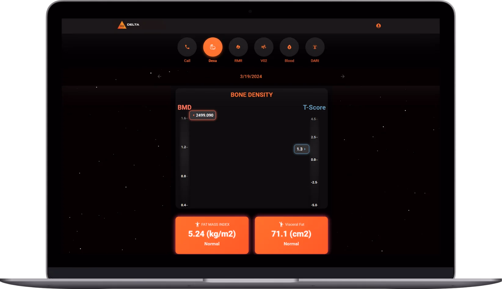 LATO AI Delta desktop dashboard showing bone density analysis with BMD, T-score, fat mass index, and visceral fat indicators for health performance monitoring.