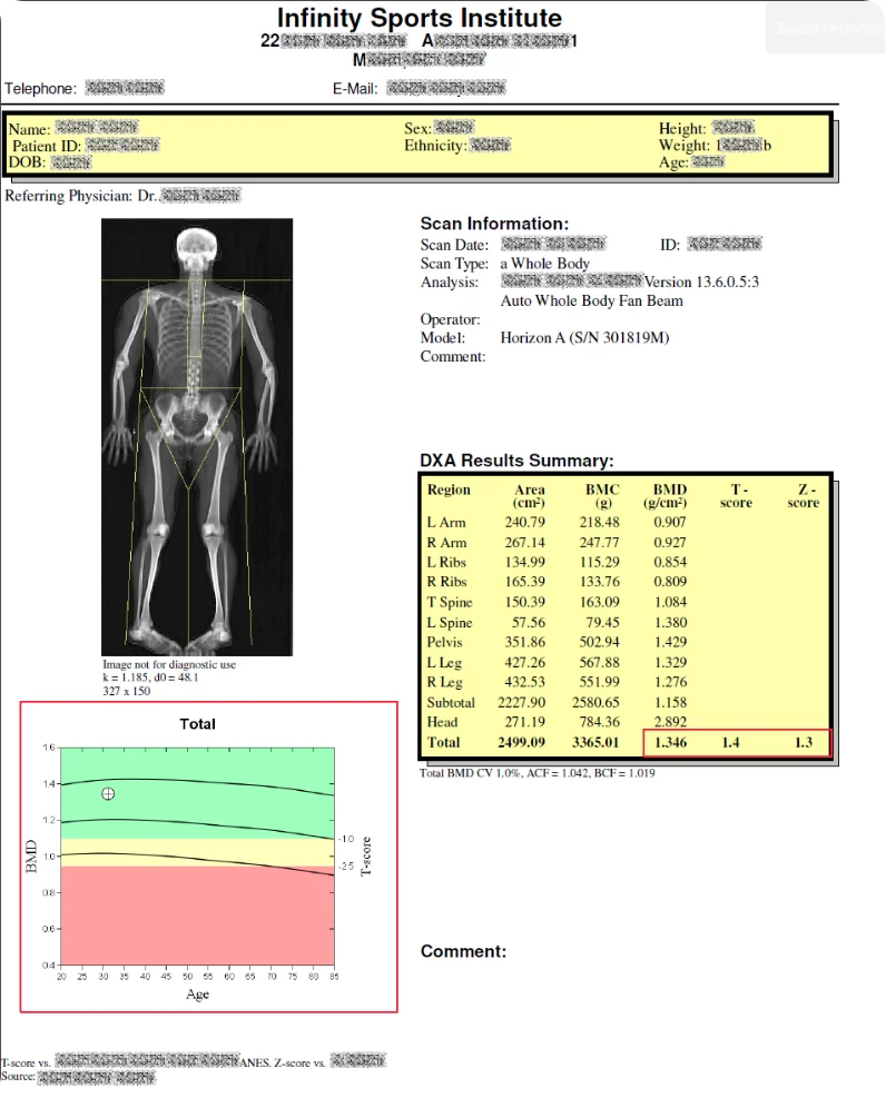 LATO AI Delta integrated health report displaying DXA scan results with bone density analysis, body composition metrics, and graphical summary for patient evaluation.